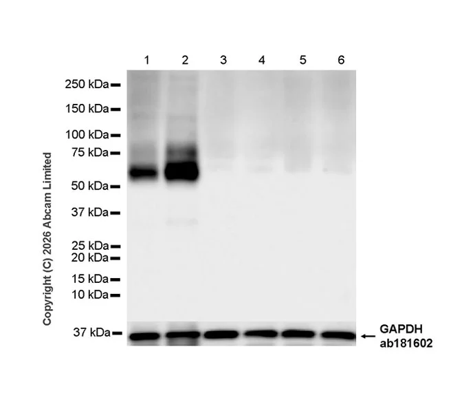 Western blot - Anti-PLCZ1 antibody [EPR29768-13R] (AB327089)