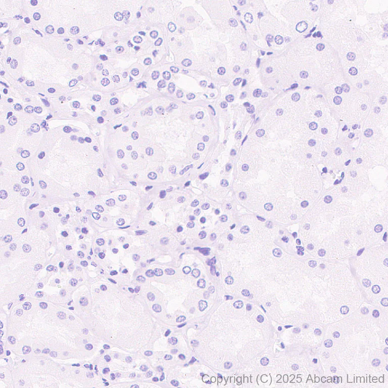 Immunohistochemistry (Formalin/PFA-fixed paraffin-embedded sections) - Anti-PLCZ1 antibody [EPR29768-46] (AB325528)