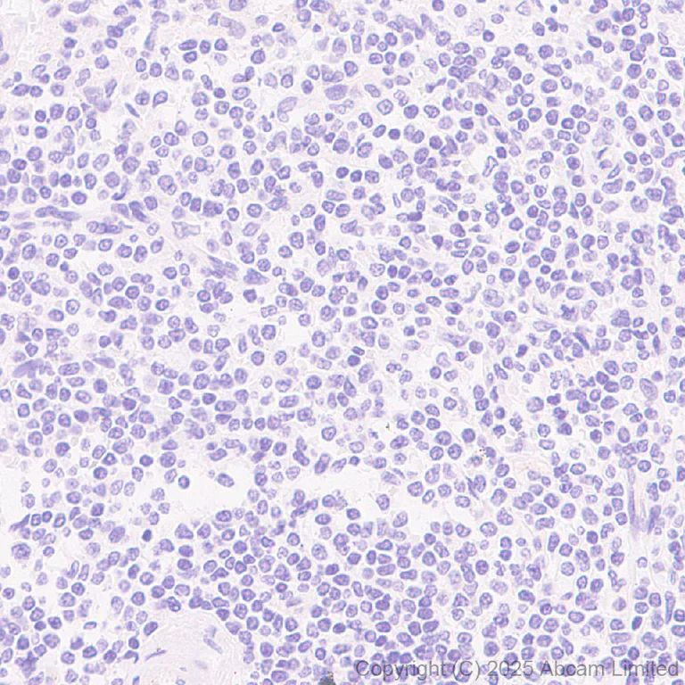 Immunohistochemistry (Formalin/PFA-fixed paraffin-embedded sections) - Anti-PLCZ1 antibody [EPR29768-46] (AB325528)