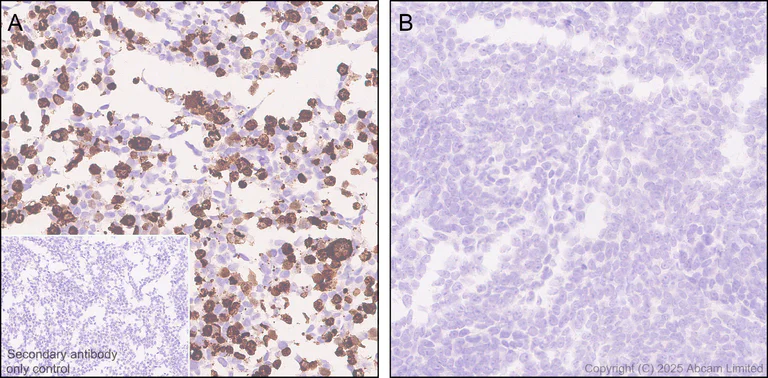 Immunohistochemistry (Formalin/PFA-fixed paraffin-embedded sections) - Anti-PLCZ1 antibody [EPR29768-46] (AB325528)