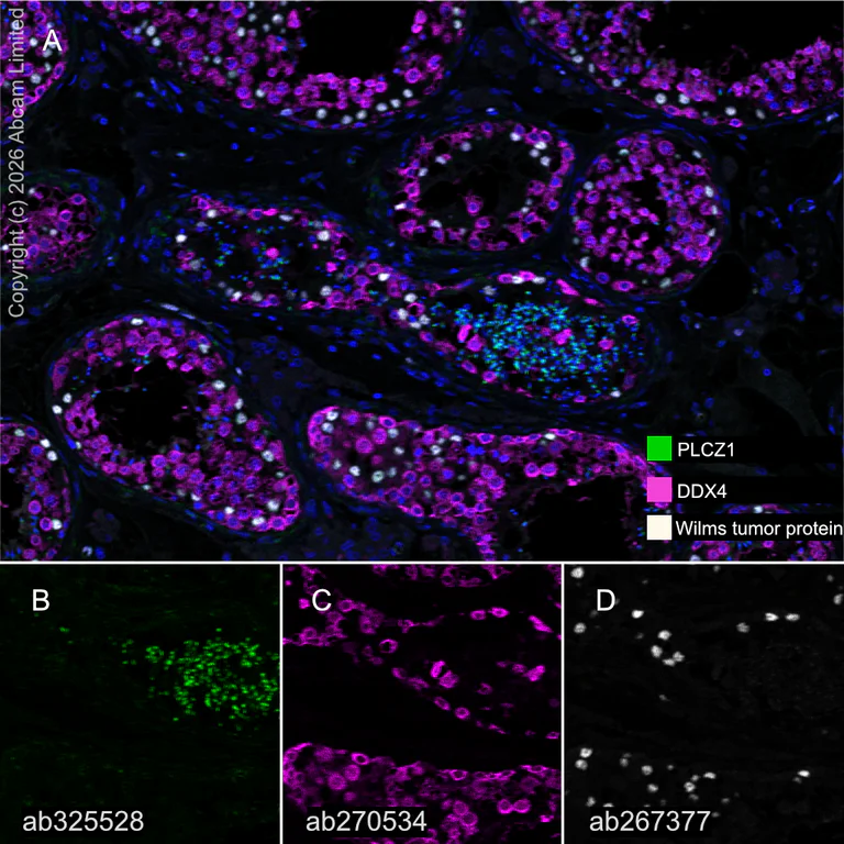 Multiplex immunohistochemistry - Anti-PLCZ1 antibody [EPR29768-46] (AB325528)