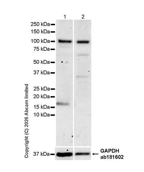 Western blot - Anti-PLD2 antibody [EPR30473-503] (AB326067)