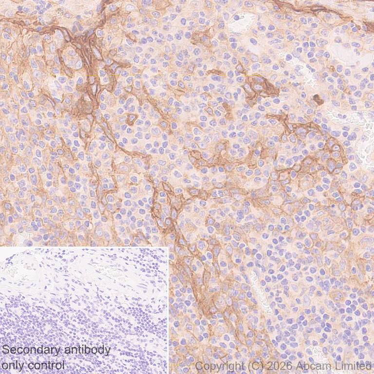 Immunohistochemistry (Formalin/PFA-fixed paraffin-embedded sections) - Anti-PLD2 antibody [EPR30473-503] - BSA and Azide free (AB326050)