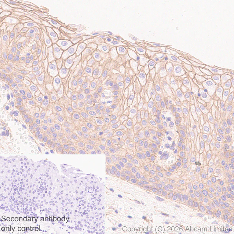 Immunohistochemistry (Formalin/PFA-fixed paraffin-embedded sections) - Anti-PLD2 antibody [EPR30473-503] - BSA and Azide free (AB326050)