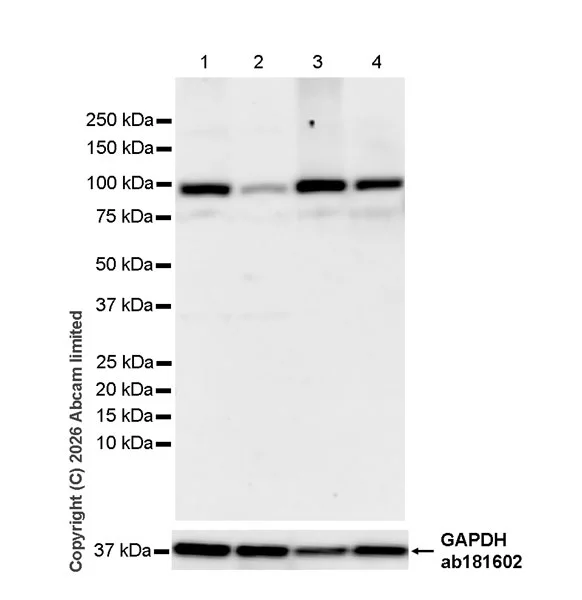 Western blot - Anti-PLD2 antibody [EPR30473-503] - BSA and Azide free (AB326050)