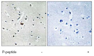Immunohistochemistry (Formalin/PFA-fixed paraffin-embedded sections) - Anti-PLD2 (phospho Y169) antibody (AB78907)