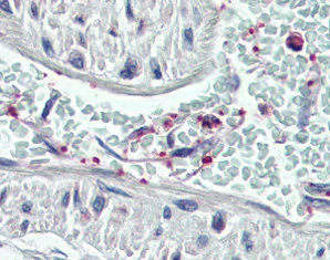 Immunohistochemistry (Formalin/PFA-fixed paraffin-embedded sections) - Anti-Pleckstrin antibody (AB115514)