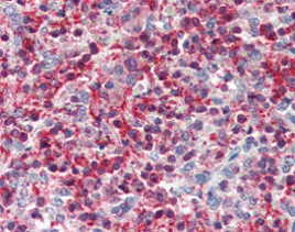 Immunohistochemistry (Formalin/PFA-fixed paraffin-embedded sections) - Anti-Pleckstrin antibody (AB115514)