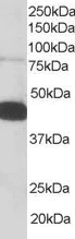 Western blot - Anti-Pleckstrin antibody (AB115514)
