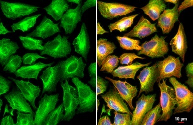 Immunocytochemistry/ Immunofluorescence - Anti-Plectin antibody - C-terminal (AB229476)