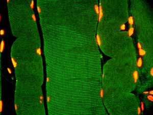 Immunohistochemistry (Formalin/PFA-fixed paraffin-embedded sections) - Anti-Plectin antibody [E398P] (AB32528)