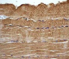 Immunohistochemistry (Formalin/PFA-fixed paraffin-embedded sections) - Anti-Plectin antibody [E398P] (AB32528)