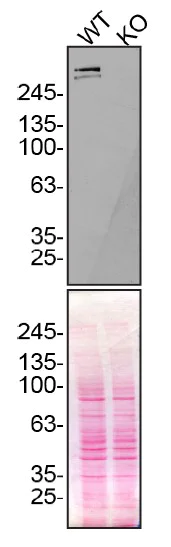 Western blot - Anti-Plectin antibody [E398P] (AB32528)