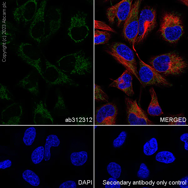 Immunocytochemistry/ Immunofluorescence - Anti-Plectin antibody [EPR26993-49] (AB312312)
