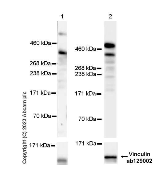 Western blot - Anti-Plectin antibody [EPR26993-49] (AB312312)