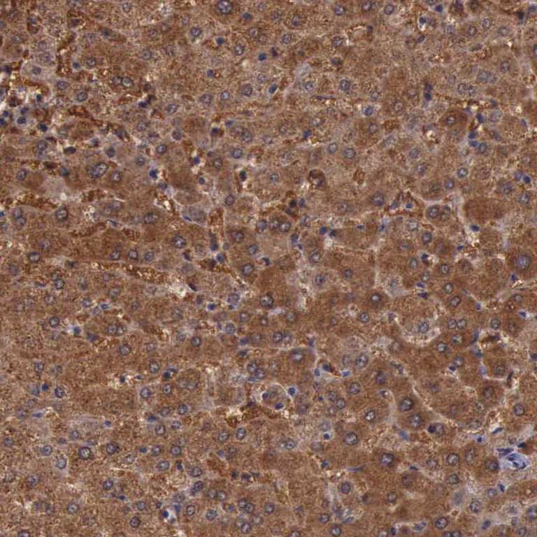 Immunohistochemistry (Formalin/PFA-fixed paraffin-embedded sections) - Anti-PLEK2 antibody (AB121131)