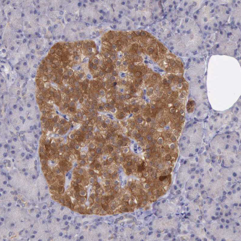 Immunohistochemistry (Formalin/PFA-fixed paraffin-embedded sections) - Anti-PLEK2 antibody (AB121131)