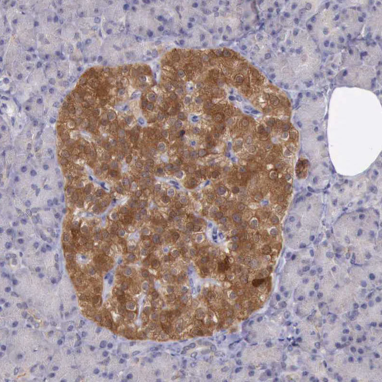 Immunohistochemistry (Formalin/PFA-fixed paraffin-embedded sections) - Anti-PLEK2 antibody (AB121131)