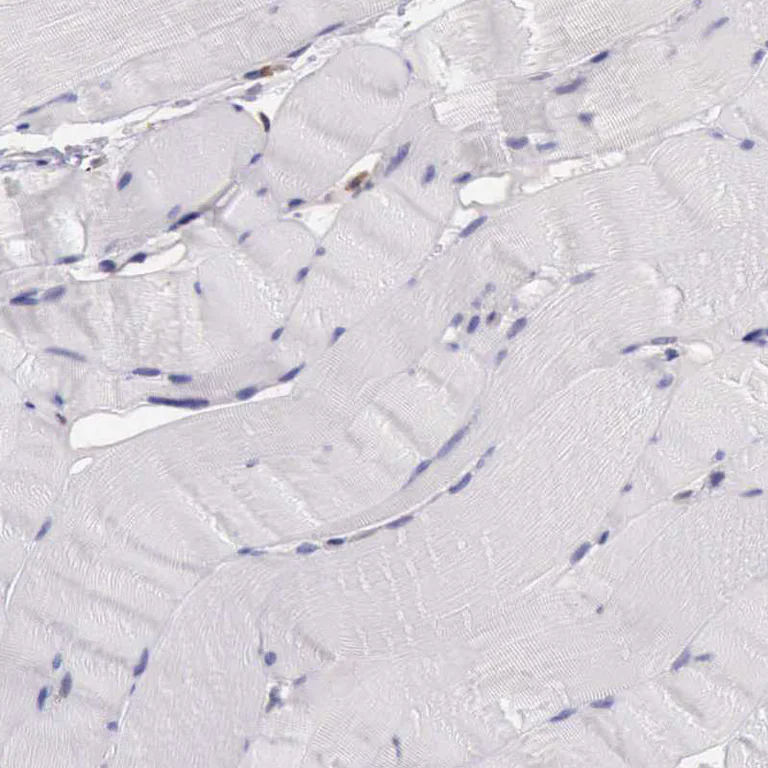 Immunohistochemistry (Formalin/PFA-fixed paraffin-embedded sections) - Anti-PLEK2 antibody (AB121131)