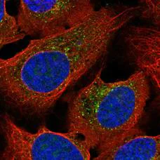 Immunocytochemistry/ Immunofluorescence - Anti-PLEKHM1 antibody (AB204437)