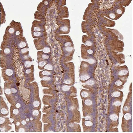 Immunohistochemistry (Formalin/PFA-fixed paraffin-embedded sections) - Anti-PLEKHM1 antibody (AB204437)