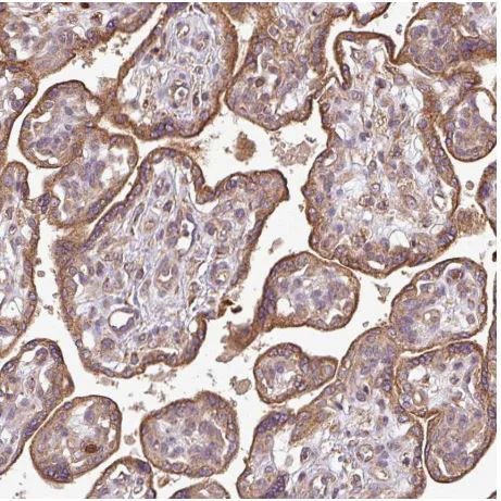 Immunohistochemistry (Formalin/PFA-fixed paraffin-embedded sections) - Anti-PLEKHM1 antibody (AB204437)