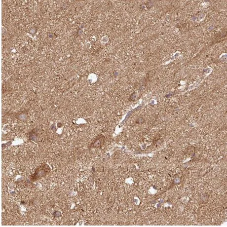 Immunohistochemistry (Formalin/PFA-fixed paraffin-embedded sections) - Anti-PLEKHM1 antibody (AB204437)