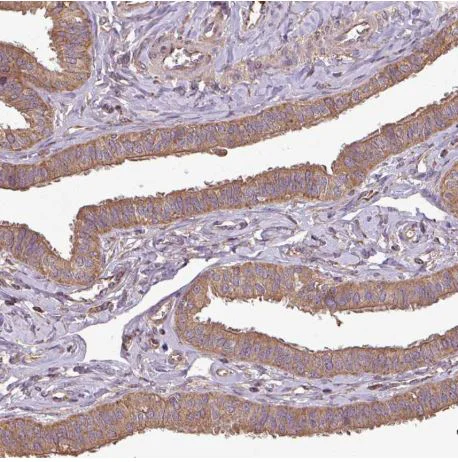 Immunohistochemistry (Formalin/PFA-fixed paraffin-embedded sections) - Anti-PLEKHM1 antibody (AB204437)