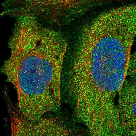 Immunocytochemistry/ Immunofluorescence - Anti-PLEKHO2 antibody (AB243708), expandable thumbnail