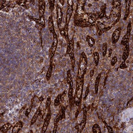 Immunohistochemistry (Formalin/PFA-fixed paraffin-embedded sections) - Anti-PLEKHO2 antibody (AB243708), expandable thumbnail