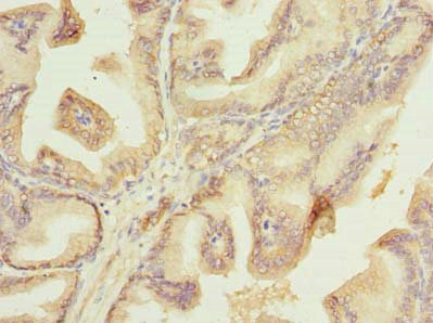 Immunohistochemistry (Formalin/PFA-fixed paraffin-embedded sections) - Anti-PLET1 antibody (AB235541), expandable thumbnail