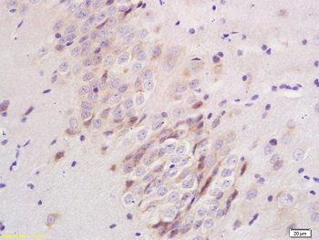 Immunohistochemistry (Formalin/PFA-fixed paraffin-embedded sections) - Anti-Plexin A1 antibody (AB217634), expandable thumbnail