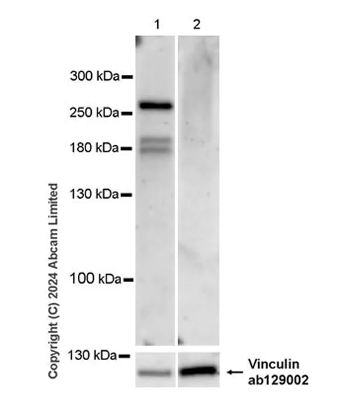 Western blot - Anti-Plexin A1 antibody [EPR29121-94] (AB321805)