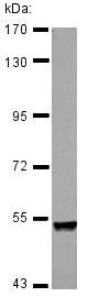Western blot - Anti-Plexin A4 antibody (AB127892)