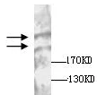 Western blot - Anti-Plexin B1 antibody (AB136880)
