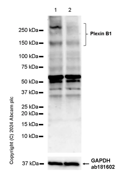 Western blot - Anti-Plexin B1 antibody [EPR26309-65] (AB316312)