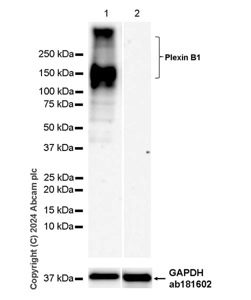 Western blot - Anti-Plexin B1 antibody [EPR26309-65] (AB316312)