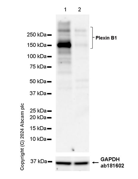 Western blot - Anti-Plexin B1 antibody [EPR26309-65] - BSA and Azide free (AB316313)