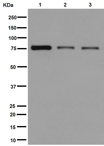 Western blot - Anti-Plexin B2/MM1 antibody [EPR9965] (AB193355)