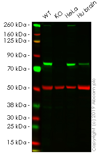 Western blot - Anti-Plexin B2/MM1 antibody [EPR9965] (AB193355)