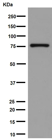 Western blot - Anti-Plexin B2/MM1 antibody [EPR9965] (AB193355)