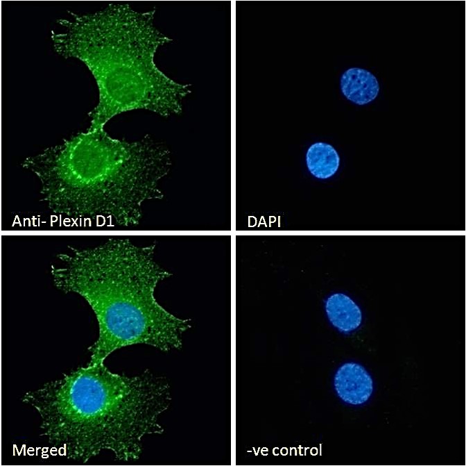Immunocytochemistry/ Immunofluorescence - Anti-Plexin D1 antibody (AB28762), expandable thumbnail