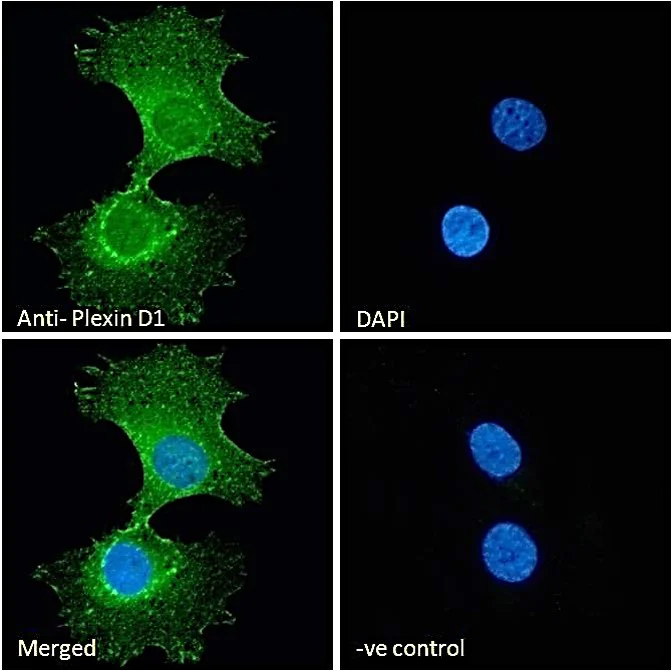 Immunocytochemistry/ Immunofluorescence - Anti-Plexin D1 antibody (AB28762)