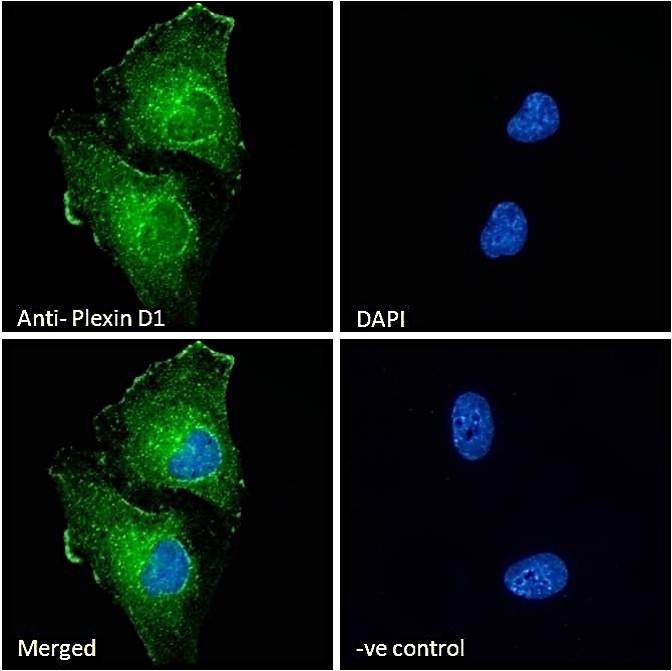 Immunocytochemistry/ Immunofluorescence - Anti-Plexin D1 antibody (AB28762), expandable thumbnail
