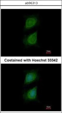 Immunocytochemistry/ Immunofluorescence - Anti-Plexin D1 antibody (AB96313)