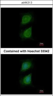 Immunocytochemistry/ Immunofluorescence - Anti-Plexin D1 antibody (AB96313)