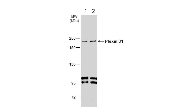 Western blot - Anti-Plexin D1 antibody (AB96313)