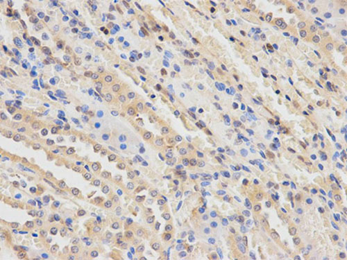 Immunohistochemistry (Formalin/PFA-fixed paraffin-embedded sections) - Anti-PLGF antibody (AB196666)