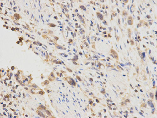 Immunohistochemistry (Formalin/PFA-fixed paraffin-embedded sections) - Anti-PLGF antibody (AB196666)