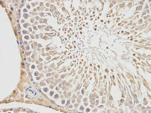Immunohistochemistry (Formalin/PFA-fixed paraffin-embedded sections) - Anti-PLGF antibody (AB196666)